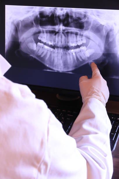 Best Emergency Dental Filling Replacement  in Wise, VA
