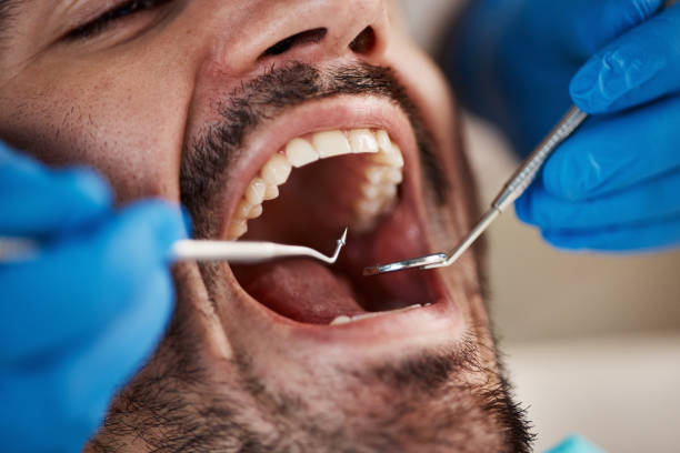 Dentist for Dental Trauma in VA